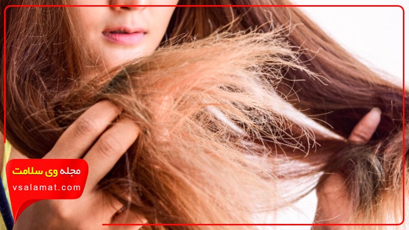 چگونه موی خشک را تشخیص دهیم؟