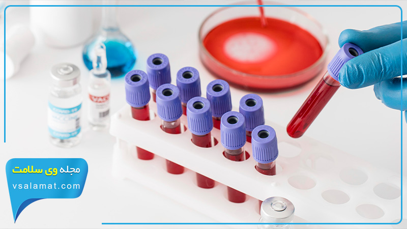 آزمایش های خونی برای بررسی آنتی‌بادی‌های بدن یکی از روش های تشخیص سندرم شوگرن است.