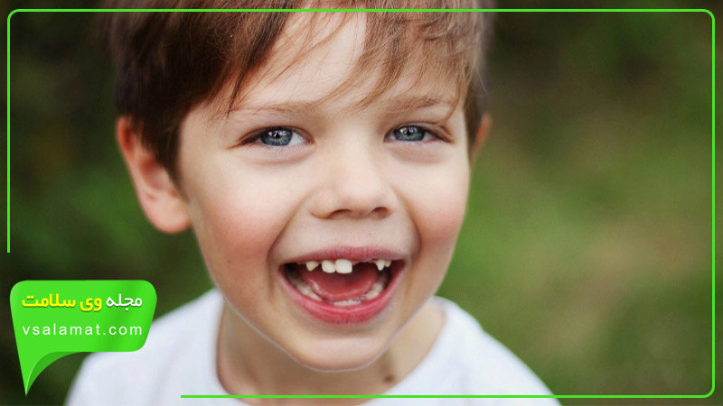 در بیماری هیپودنشیا، به طور مادرزادی جای بعضی از دندان ها خالی است و هرگز دندانی در آن جا رشد نمی کند.